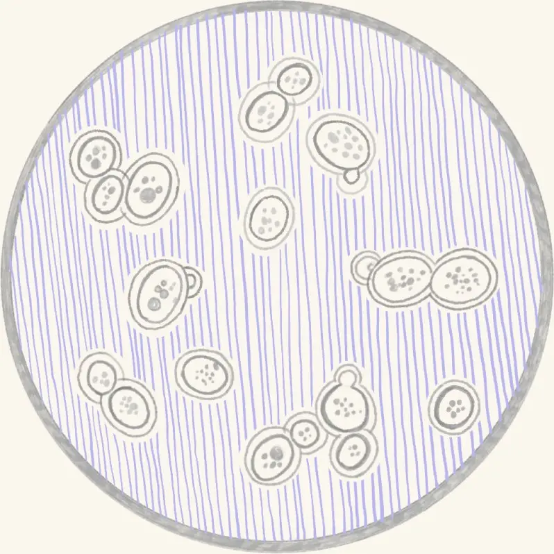 A petri dish of bacterial colonies